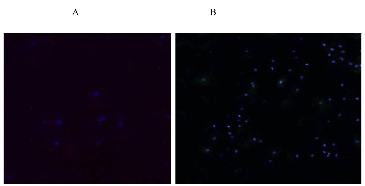 Экспрессия INK-ATTAC в культуре клеток человека под влиянием пептида IPH REG. Конфокальная микроскопия. Х400. ideal pharma